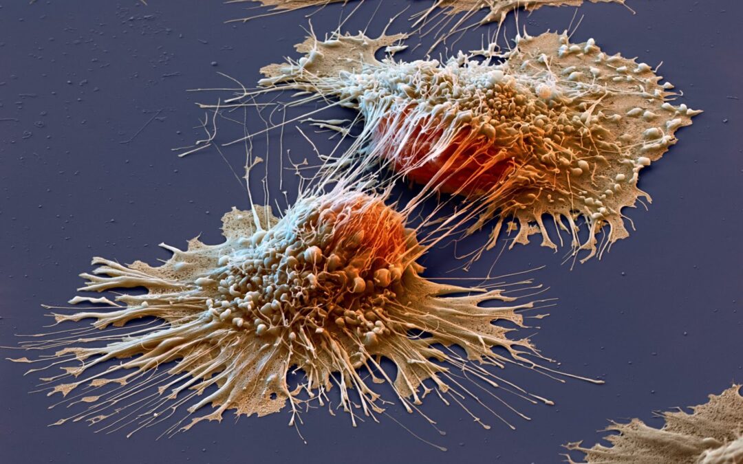 Princeton cancer researchers find that tumors’ metabolism is slower than suspected.