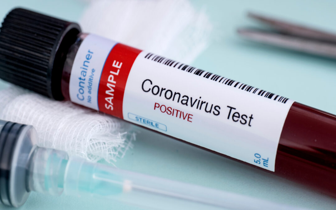 Coronavirus Test Results Are Faster but Still Too Slow for Contact Tracing, National Survey Says