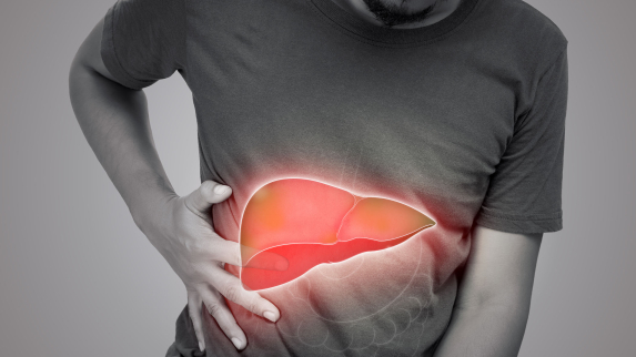How a Simple Dietary Change May Slow Liver Cancer in At-Risk Patients.