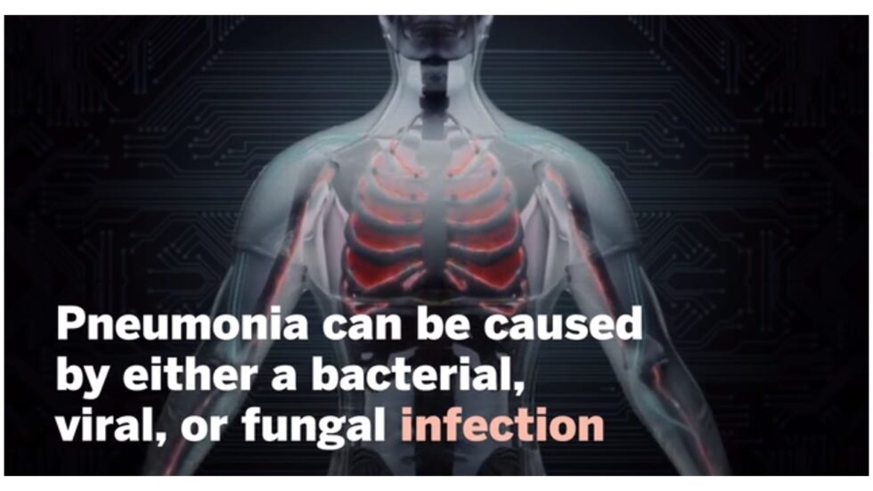 how contagious is pneumonia