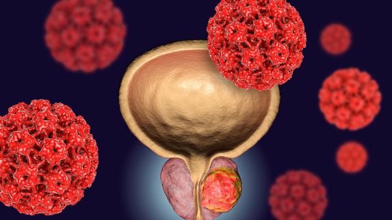 Strategy to Boost Prostate Cancer Treatment Efficacy Devised at Rutgers Health.