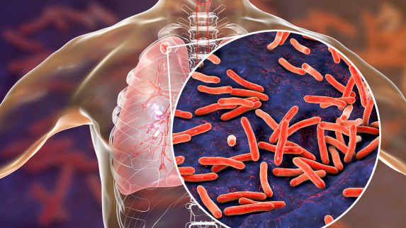 Researchers Reveal Why a Key Tuberculosis Drug Works Against Resistant Strains.